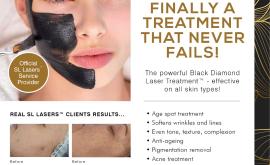 Black Diamond Laser treatment for N$950